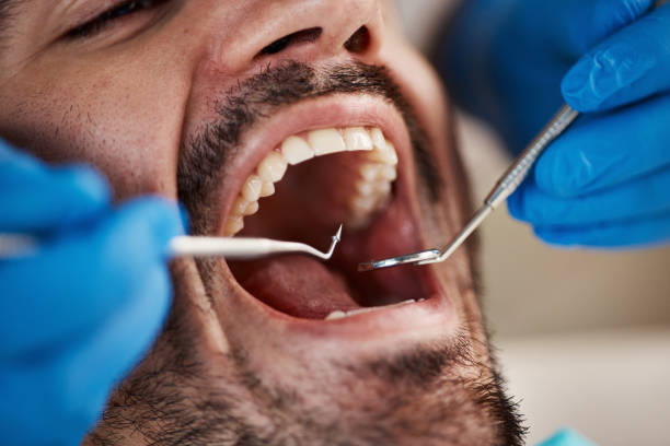 Best Emergency Dental Services for Seniors in Burton, OH