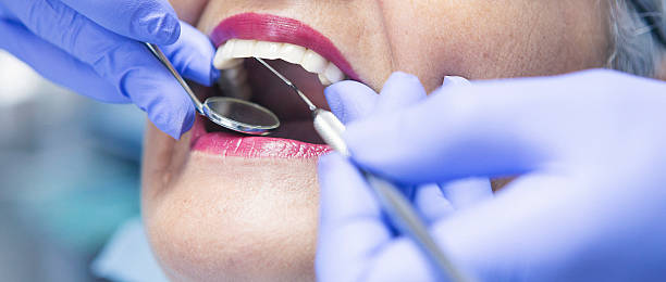 Best Emergency Dentist for Lost Fillings or Crowns in Burton, OH